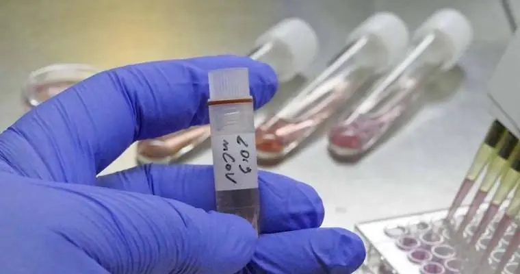 Polski test na koronawirusa wkrótce trafi do produkcji | FXMAG